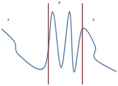 Melodic Shape 2